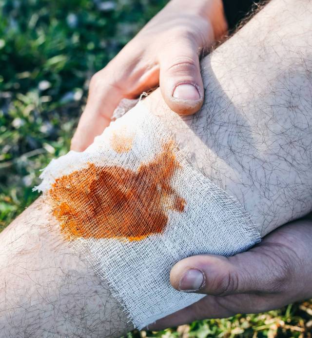 wound care clinic in Washington DC